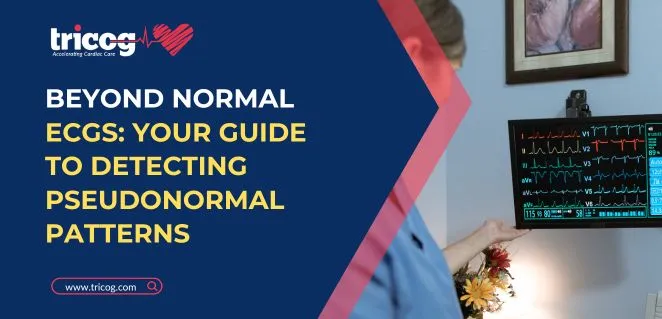 Beyond Normal ECGs: Your Guide to Detecting Pseudonormal Patterns